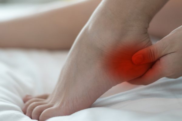 plantar fasciitis