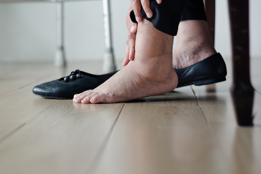 Foot Problems & Obesity How Excessive Weight Can Affect Your Feet