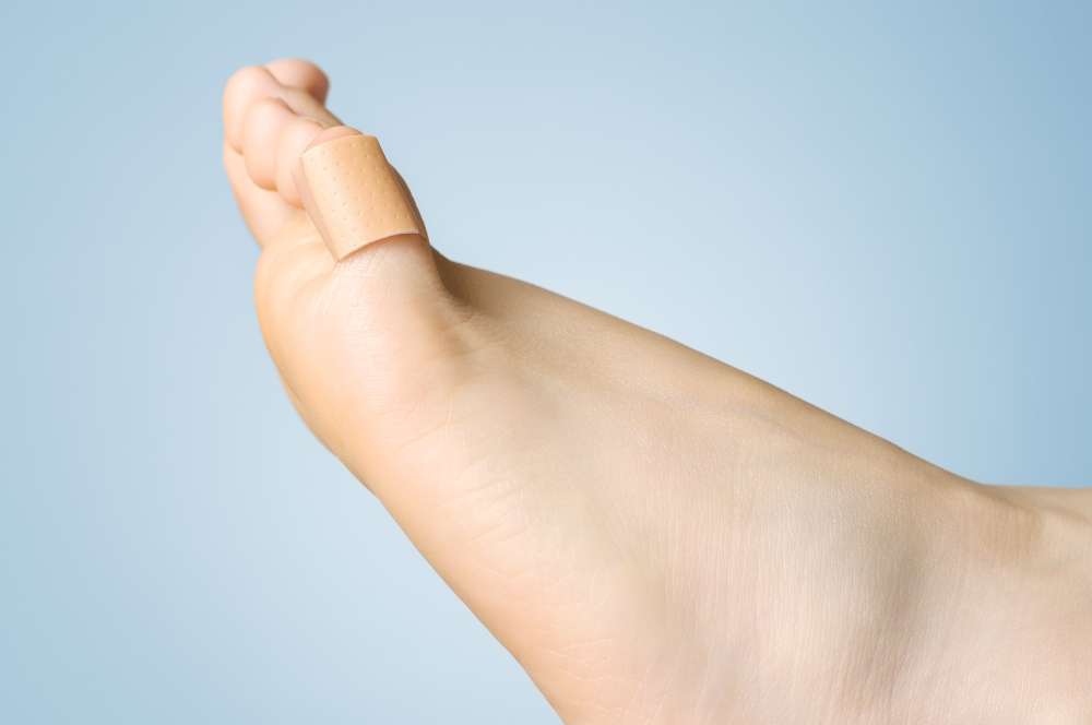Treating blister on foot