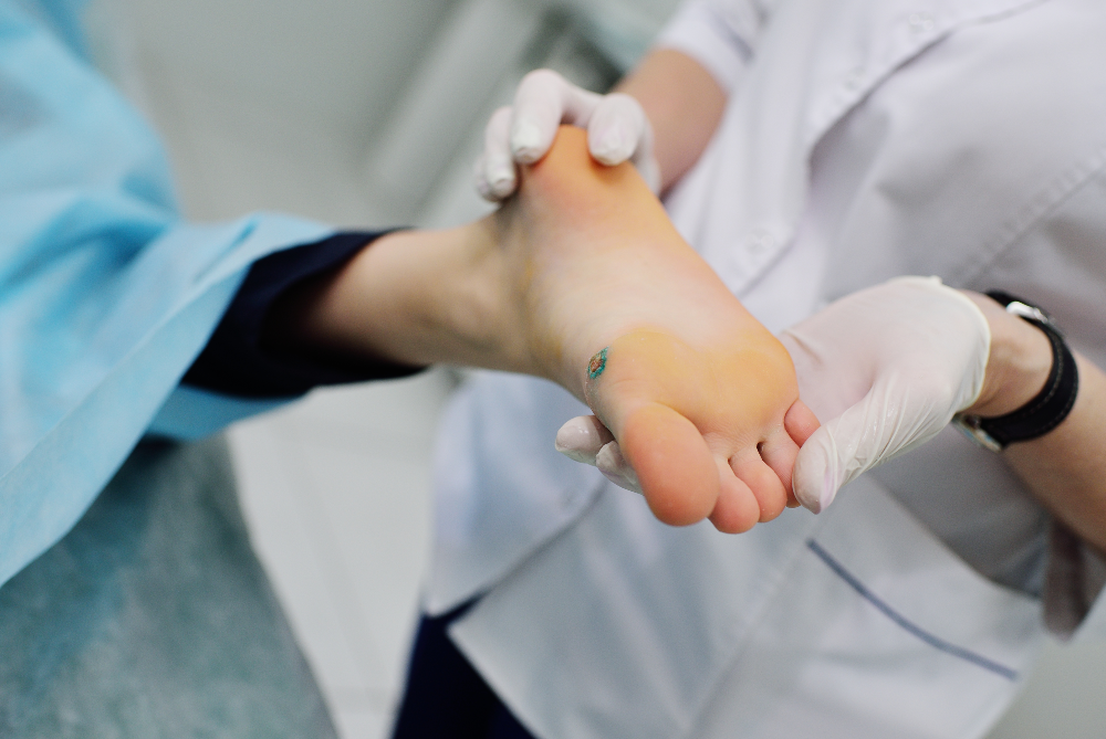 Diabetic Foot Ulcers: Why Diabetics Are at Higher Risk, Symptoms