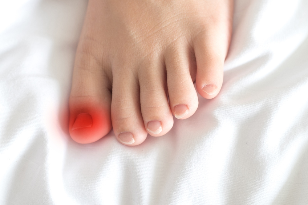 Causes, Symptoms and Treatments of Fungal Toenails