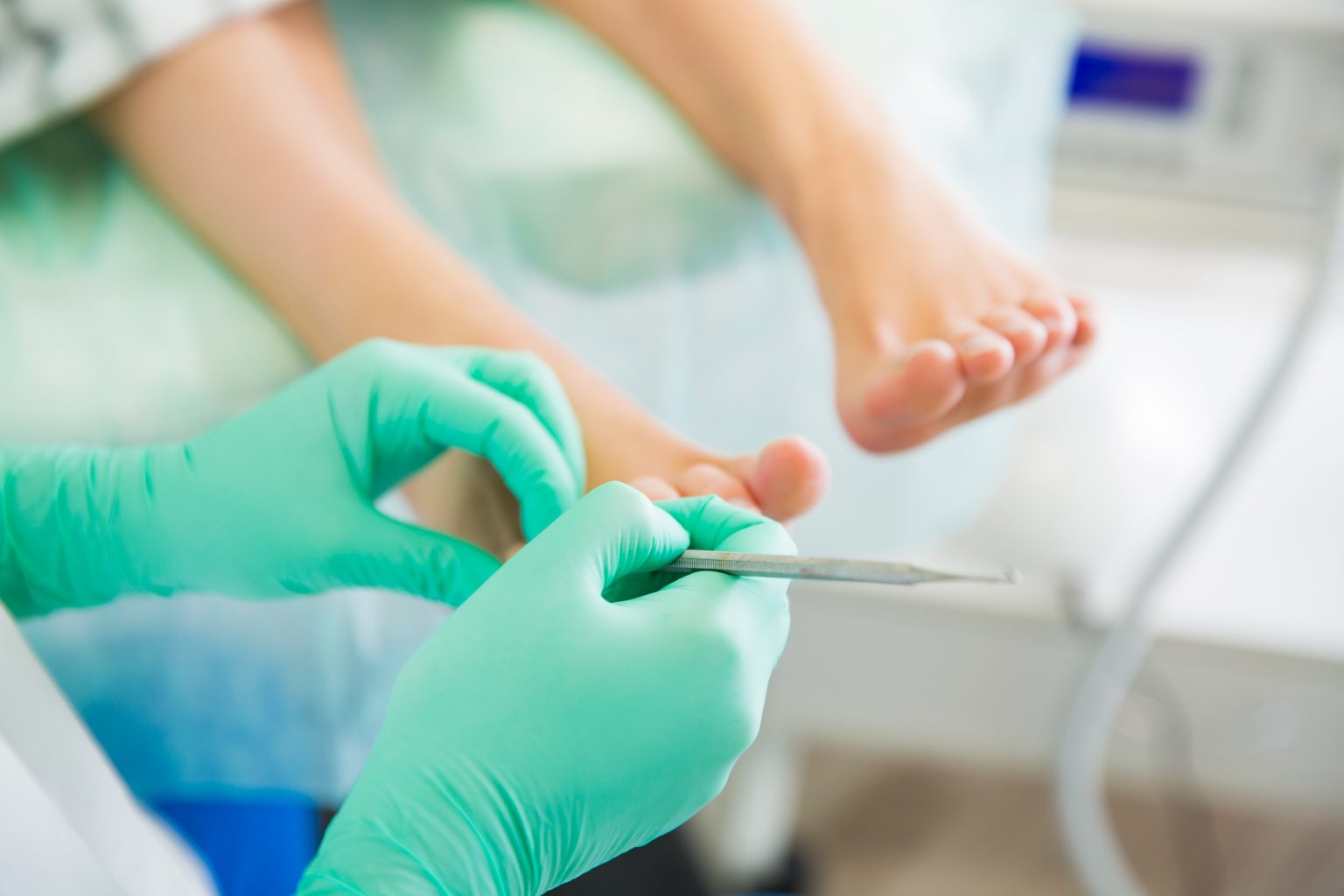 Common Toenail Injuries and How to Treat Them Foot and Ankle Group