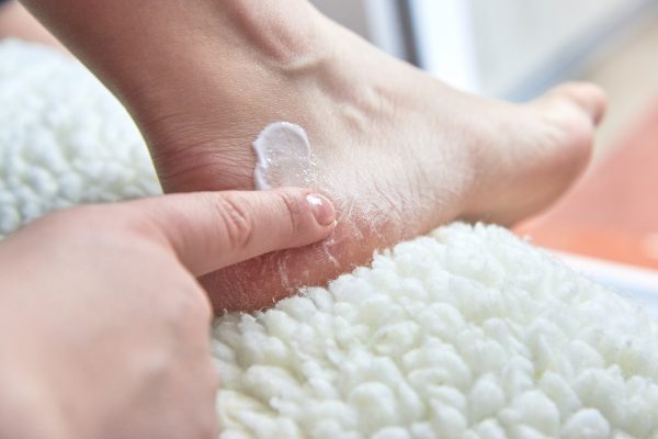 Dry Feet & Cracked Heels: Causes & Treatment