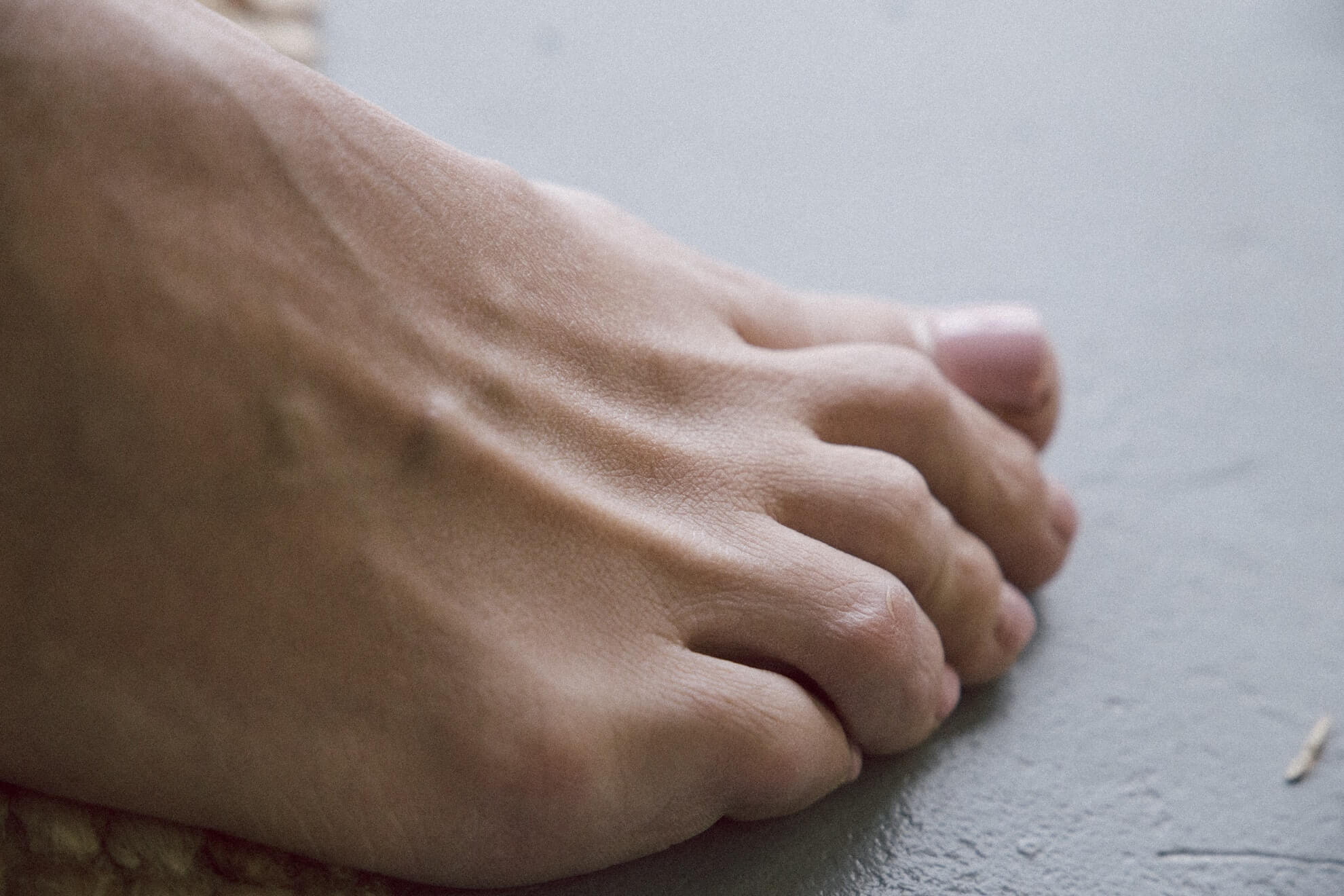 7 Signos De Artritis En Los Pies Foot And Ankle Group Abc Patient